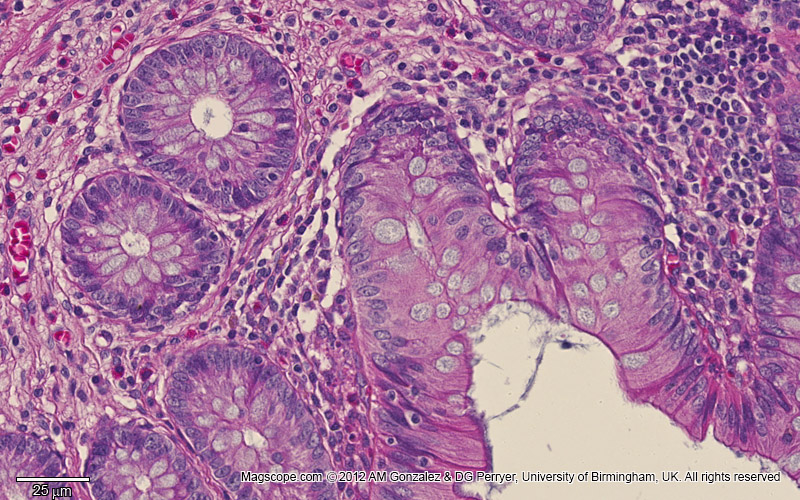 Appendix mucosa