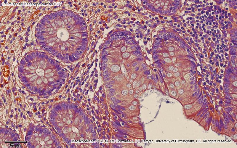 Appendix mucosa