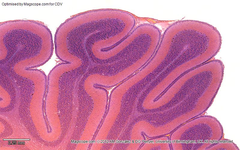 Cerebellum