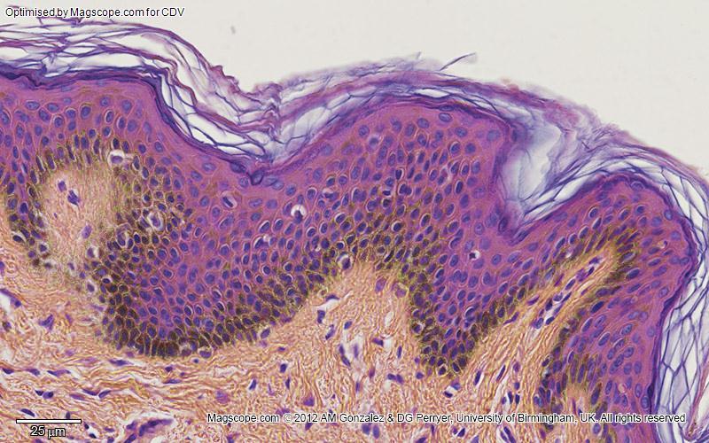 Pigmented epithelium