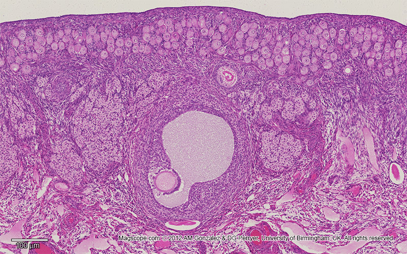 Ovary - Graafian Follicle