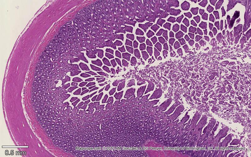 Small intestine