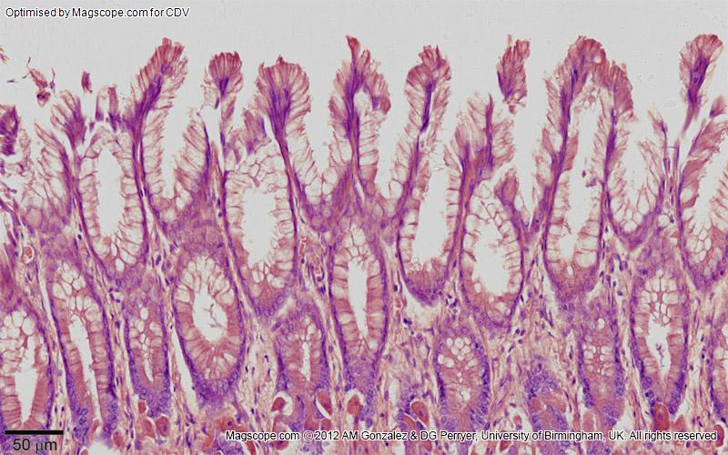 Stomach fundus